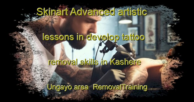 Skinart Advanced artistic lessons in develop tattoo removal skills in Kashere Ungayo area | RemovalTraining | RemovalClasses | SkinartTraining-Nigeria
